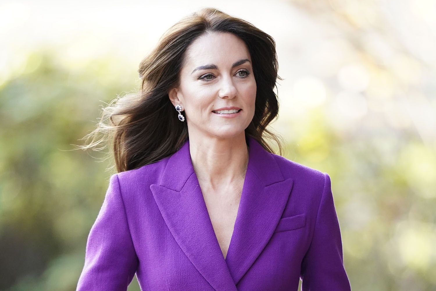 Kate Middleton Hospitalized After Abdominal Surgery, Cancels All Eng Until Easter